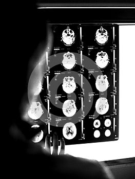 Doctor looking at CT Scan