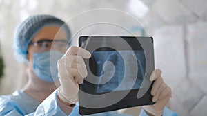 A doctor is looking at a fluorography scan of a patient with coronavirus disease.