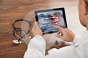 Doctor looking at human teeth x-ray