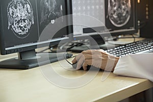 Doctor looking at MRI in computer monitor