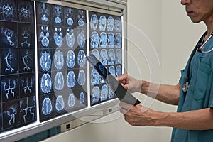 Doctor looking at MRI film of human brain