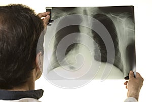 Doctor looking at X-ray