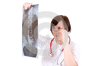 Doctor looking at x-ray of backbone, spine