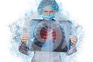 Doctor looking at a snapshot of lungs with pneumonia photo