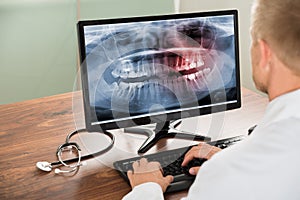 Doctor looking at teeth x-ray on computer