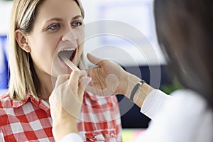 Doctor looking at throat of woman patient with wooden spatula in clinic