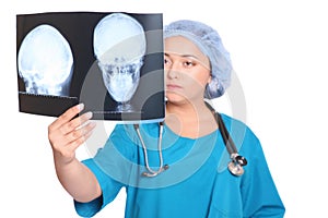 Doctor is looking at X-ray