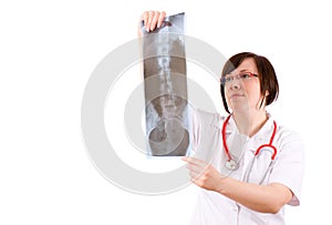 Doctor looking at x-ray of backbone, spine photo