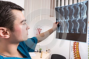 Doctor looking at X-ray image showing spine