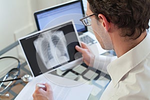 Doctor looking at x-ray of lungs, cancer diagnosis photo