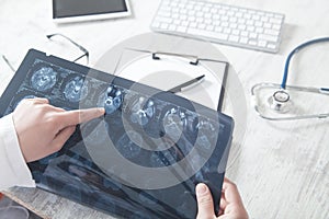 Doctor looking at xray picture of head