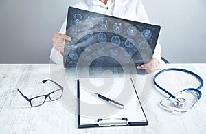 Doctor looking at xray picture of head