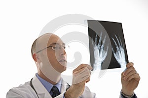 Doctor looking at xrays. photo