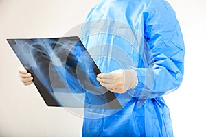 Doctor looking at xrays photo