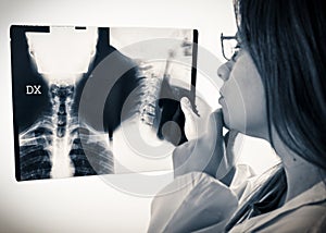 Doctor looks at x-rays