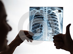 Doctor looks at x-ray of patient's lungs and shows thumb up.