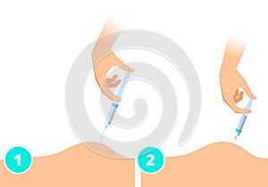 A doctor makes an intramuscular injection. Vector flat illustration