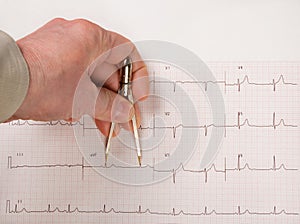 Doctor Measuring EKG Intervals With Calipers photo