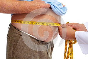 Doctor measuring obese man stomach.