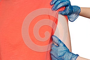 Doctor or nurse examine tuberculosis vaccine BCG marks on the shoulder of an adult woman made in childhood