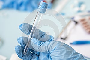A doctor or nurse holds a test tube to send it to the lab for a blood test.