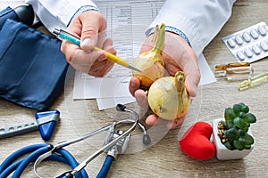 Doctor nutritionist during consultation held in his hand and shows patient onion bulb. Counseling and explanation of use of onion