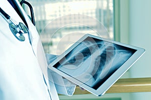 Doctor observing a chest radiograph in a tablet photo