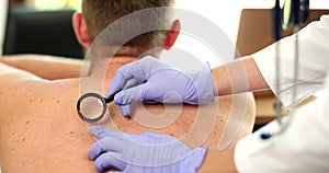 Doctor oncologist examining patient pigmented nevi with magnifying glass closeup 4k movie slow motion