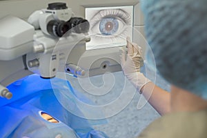 Doctor ophthalmologist, pressing the button on the control display to start a modern laser for the correction of visual impairment photo