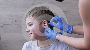 Doctor Otolaryngologist Cleans Ears, Ear Canal of a Child with a Cotton Swab. 4K