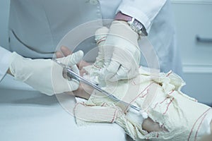 Doctor patient plaster cast