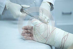 Doctor patient plaster cast