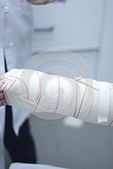 Doctor patient plaster cast