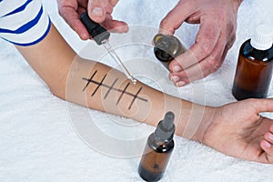 Doctor performing allergy test on skin