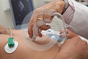 Doctor performing an echocardiogram