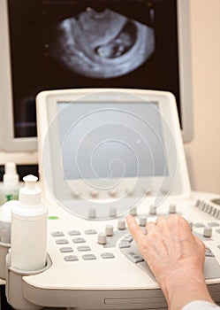 Doctor performing an ultrasound examination