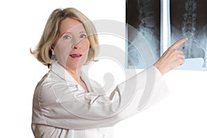 Doctor pointing at radiograph photo
