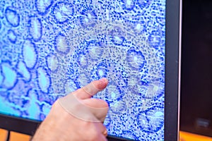 Doctor pointing at screen with amplification image of samples