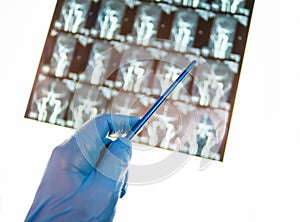 Doctor pointing at x-ray image