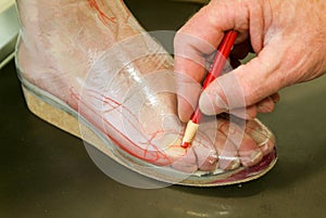 Doctor preparing orthopedic insoles for a patient