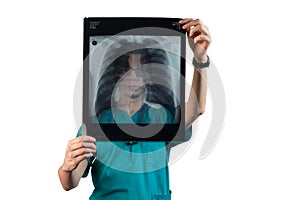 Doctor pulmonologist looks at an X-ray of the patient`s breast cell. Lung health, complications from coronavirus