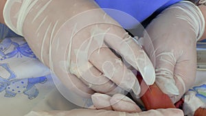 A doctor punctures a vein with a needle on the leg of a premature newborn baby lying in the intensive care unit. The doctor