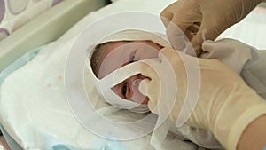 Doctor puts a newborn with a clamp on the umbilical cord