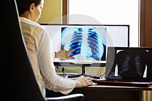 Doctor radiographer looking at x ray on computer screen photo