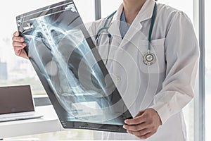 Doctor with radiological chest x-ray film for medical diagnosis on patientâ€™s health on asthma, lung disease and bone cancer