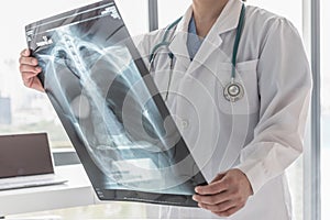 Doctor with radiological chest x-ray film for medical diagnosis on patientÃ¢â¬â¢s health on asthma, lung disease and bone cancer