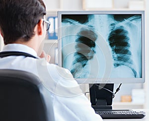 Doctor radiologist looking at x-ray images
