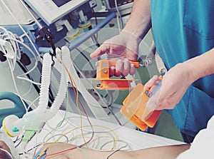 Doctor is ready for cardioversion