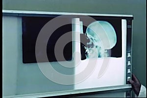 Doctor reviewing roentgenograms of skull on lightbox
