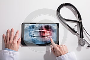 Doctor`s Hand And Digital Tablet Screen Showing Teeth X-ray